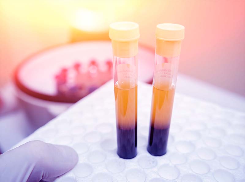 , Regenerative Medicine Overview